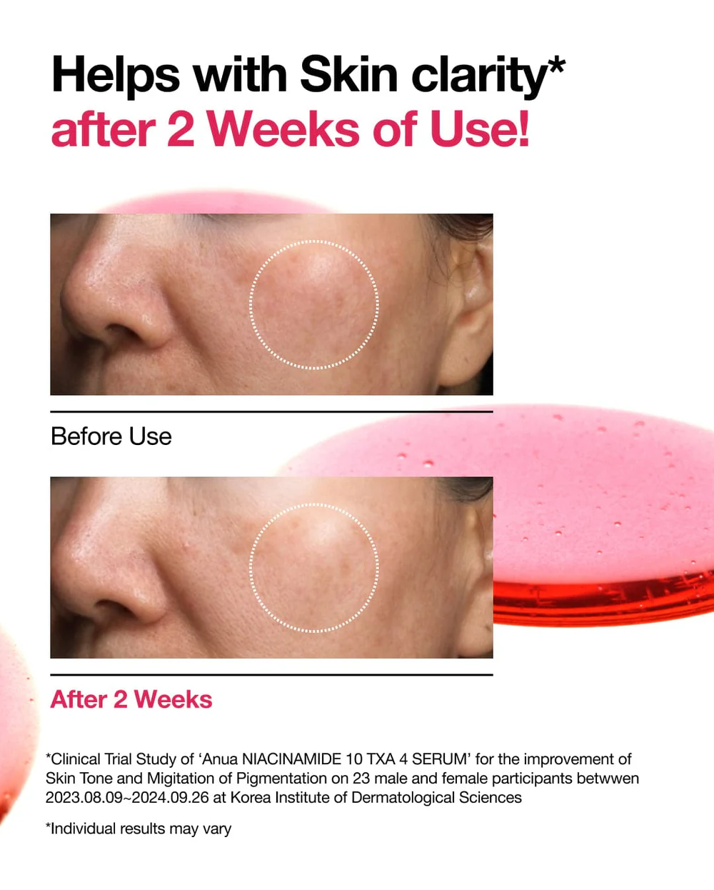 Niacinamide 10% + TXA 4% Serum - Imagen 2