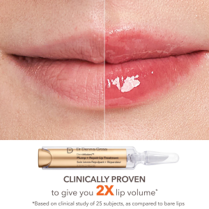 Lip Value Set - Bajo Pedido