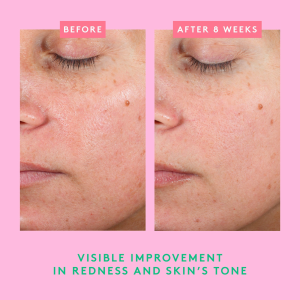 Moisture Everlasting: Bora Barrier Refill Kit - Bajo Pedido