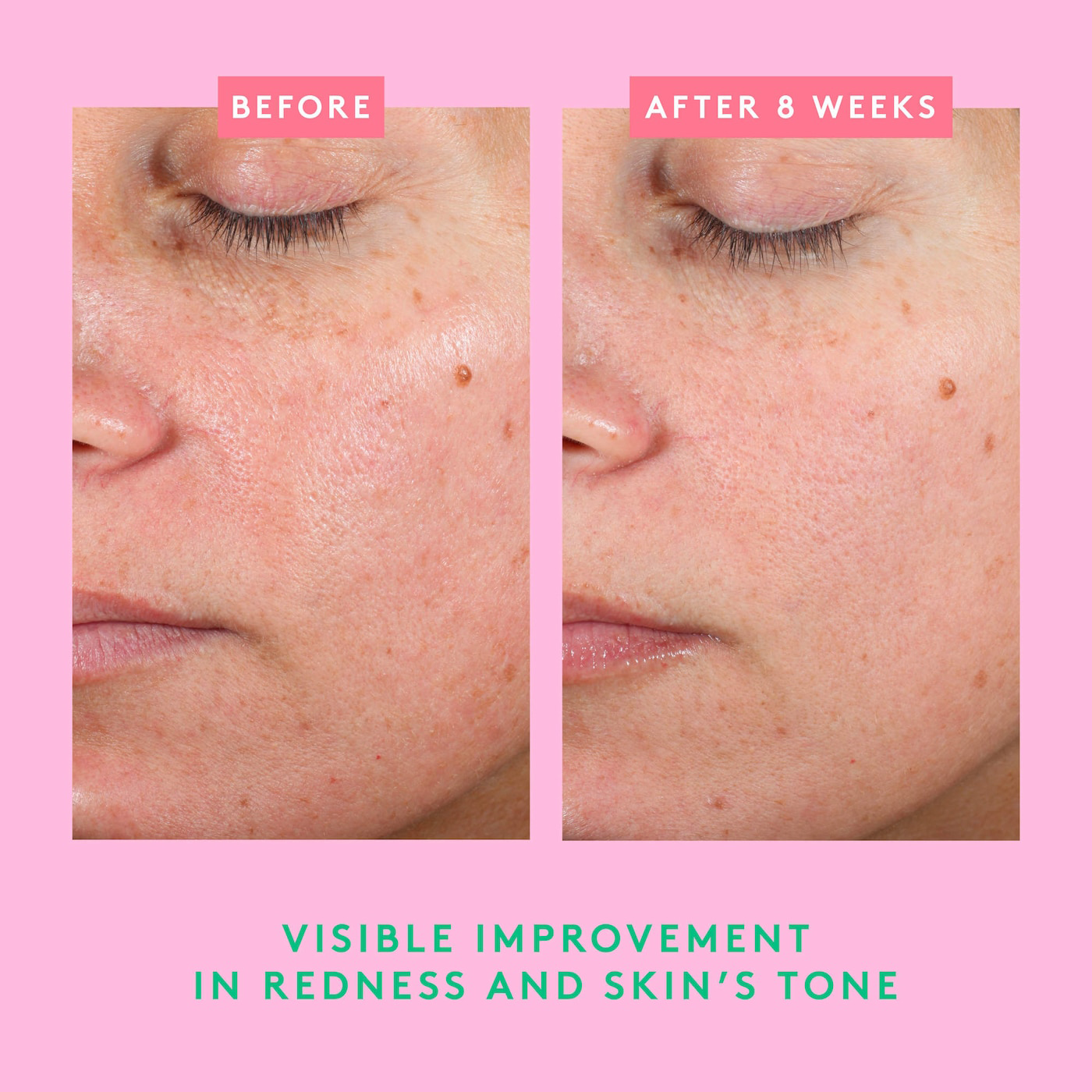 Moisture Everlasting: Bora Barrier Refill Kit - Bajo Pedido - Imagen 4