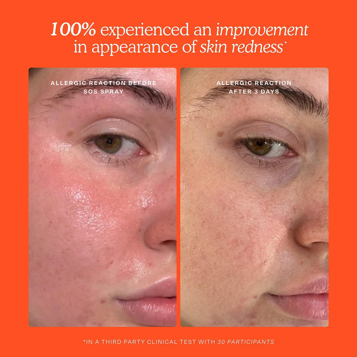 Mini SOS Skincare Bestsellers Set - Bajo Pedido - Imagen 4