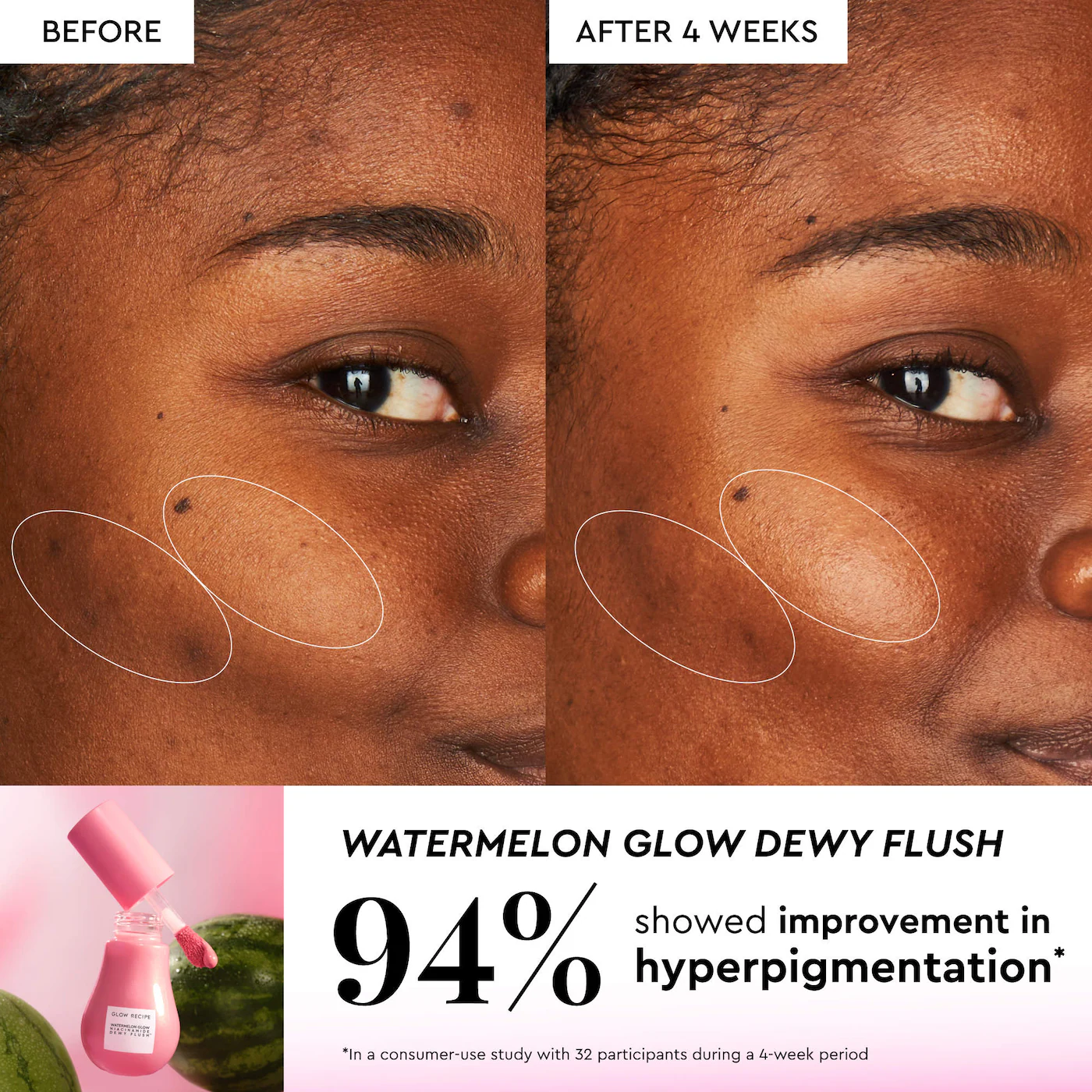 Glow Recipe X Beautyblender Watermelon Glow Bestsellers-Bajo Pedido